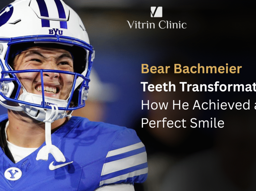 Bear Bachmeier Teeth Transformation: How He Achieved a Perfect Smile