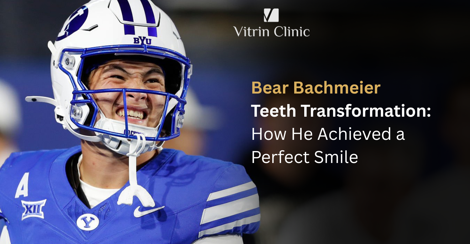 Bear Bachmeier Teeth Transformation: How He Achieved a Perfect Smile
