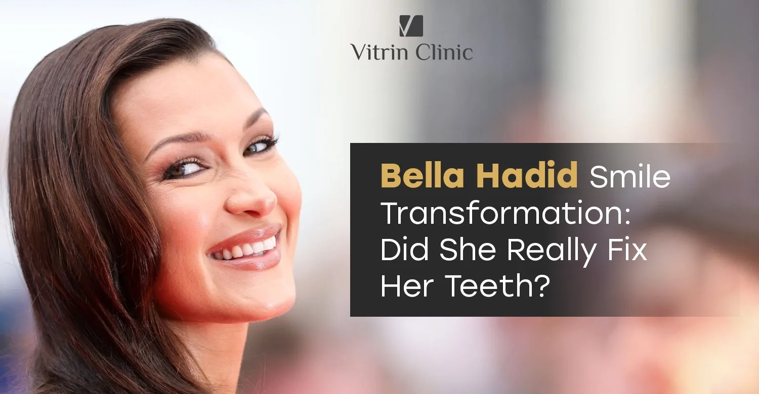 Bella Hadid teeth