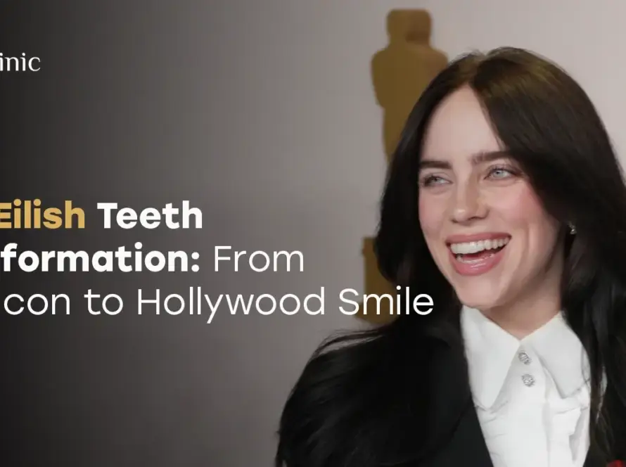 Billie Eilish Teeth Transformation: From Teen Icon to Hollywood Smile 2026