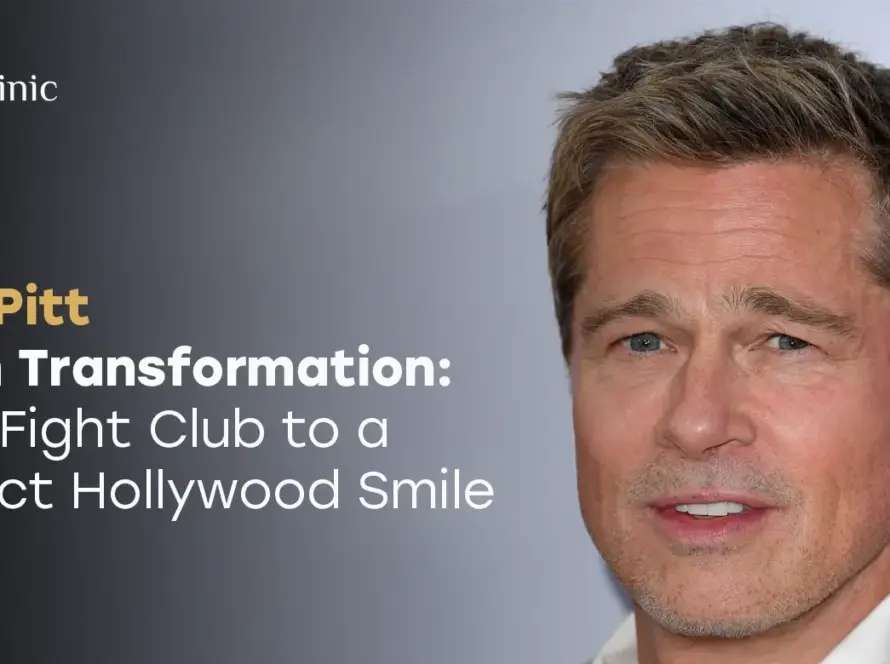 Brad Pitt Teeth