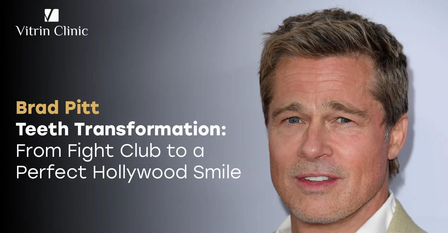 Brad Pitt Teeth