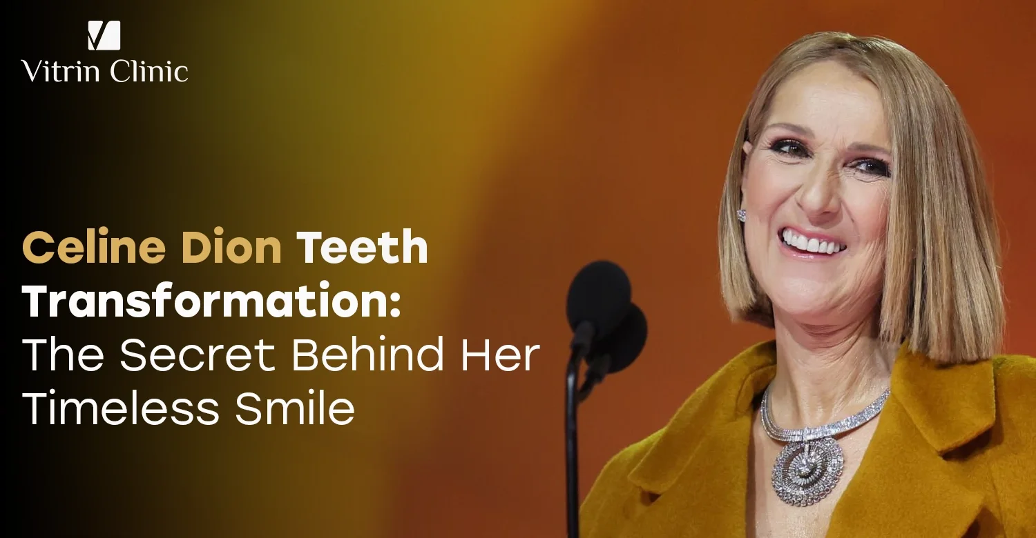 Celine Dion Teeth: Secrets Behind Her Timeless Smile
