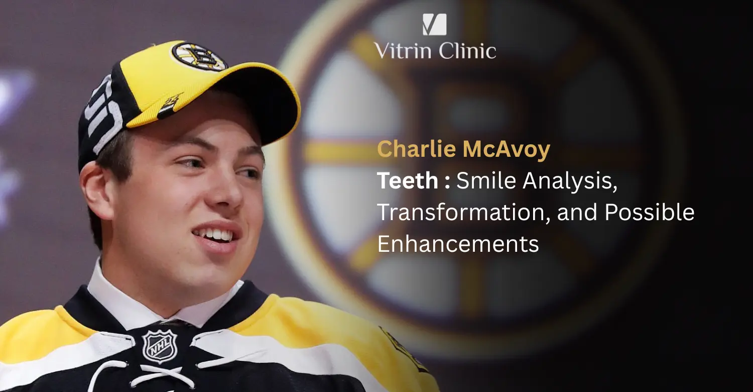 Charlie McAvoy Teeth