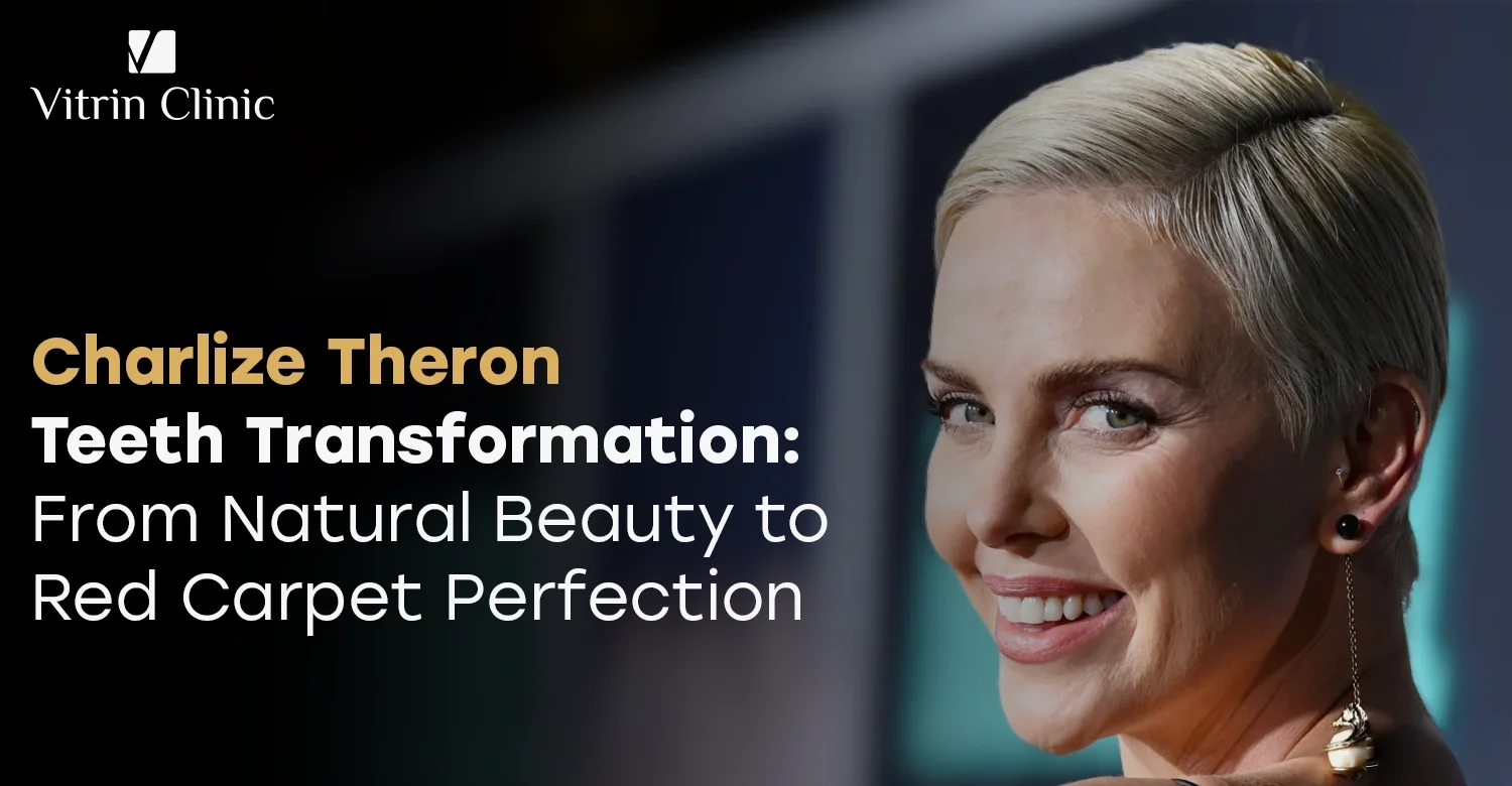 Charlize Theron Teeth: Her Complete Smile Transformation Guide