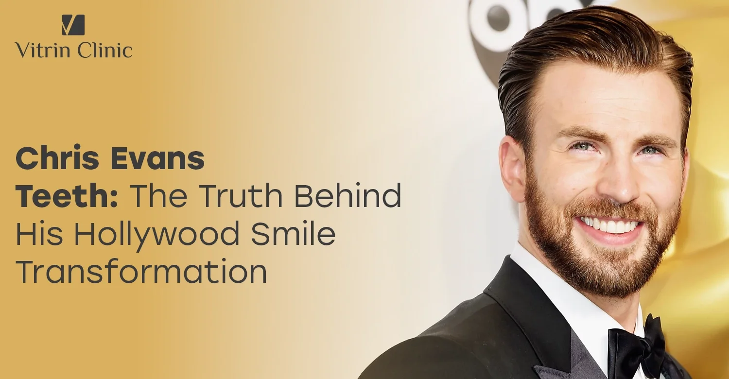 Chris Evans Teeth