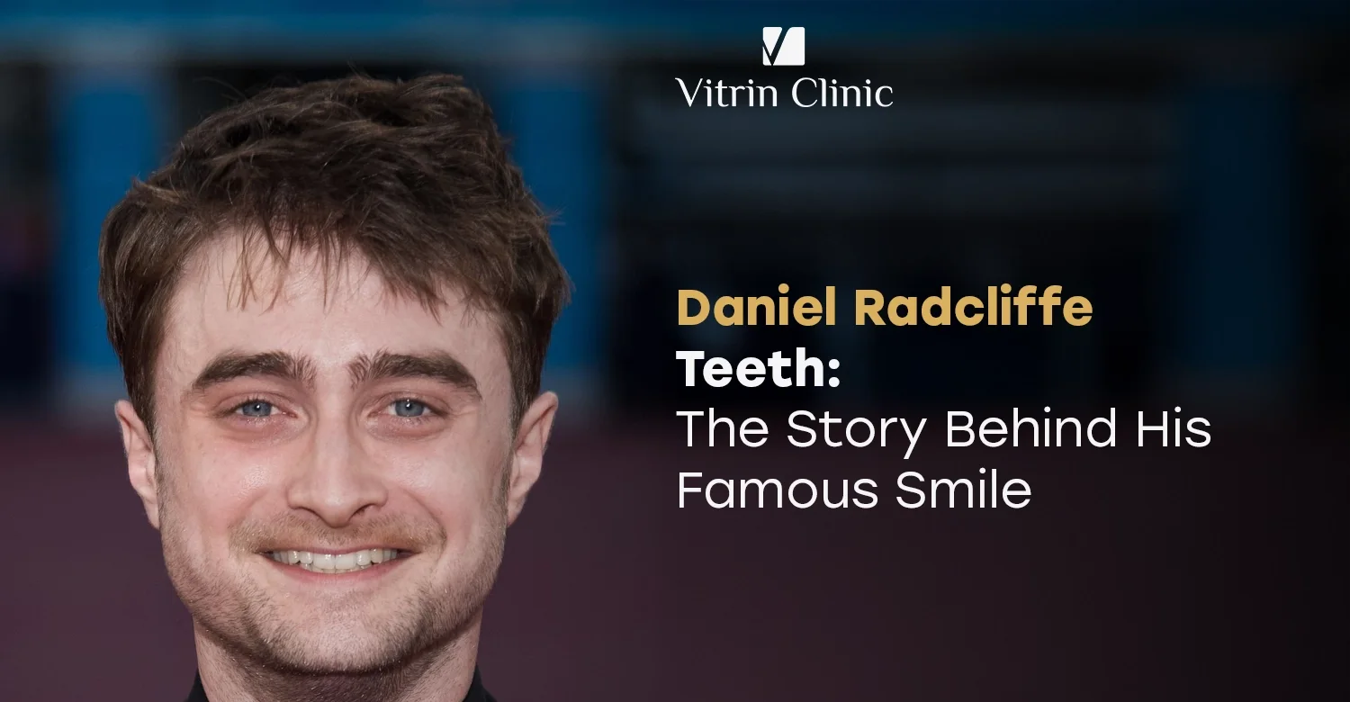 Daniel Radcliffe Teeth 2026