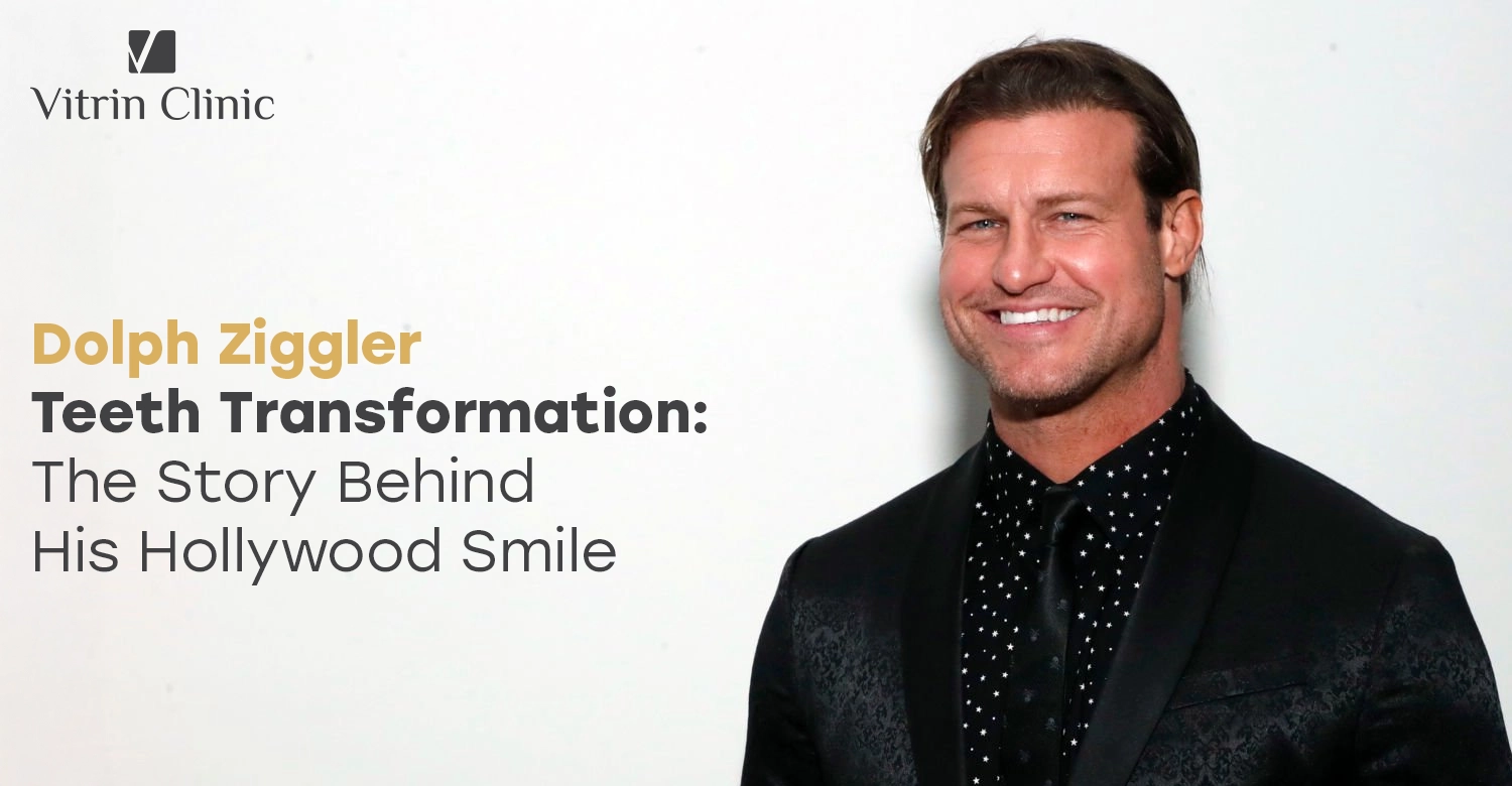 Dolph Ziggler Teeth