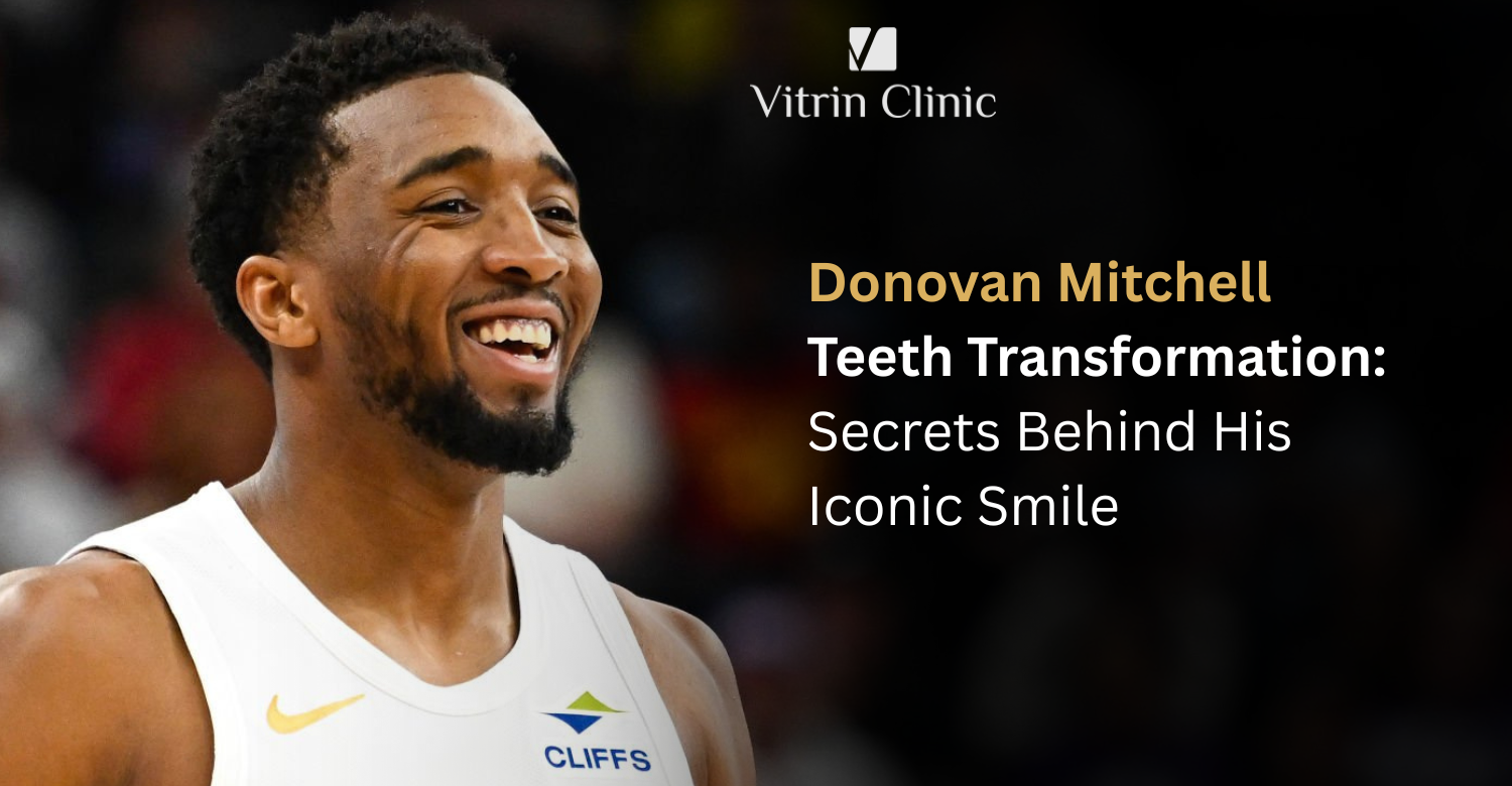 donovan mitchell teeth