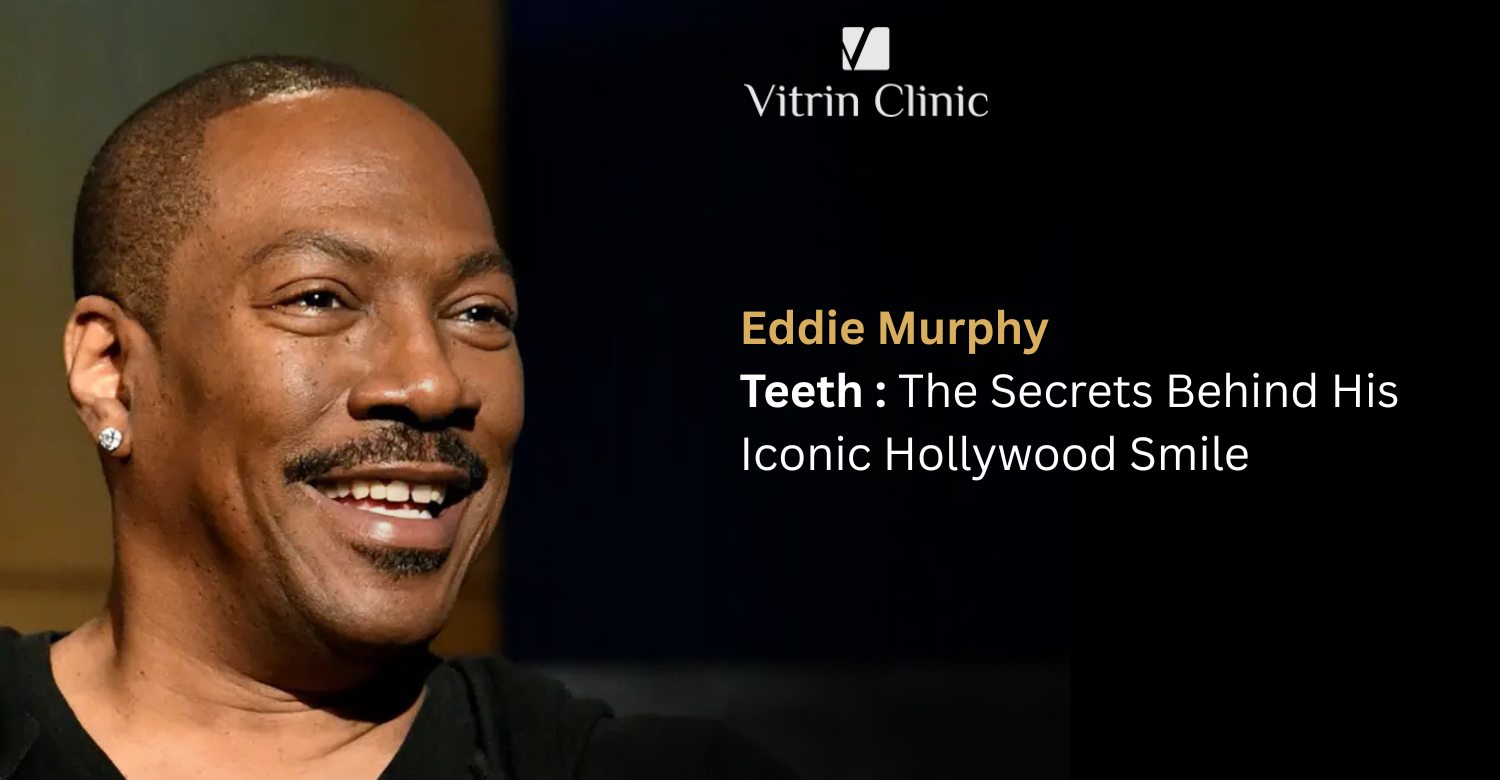Eddie Murphy Teeth