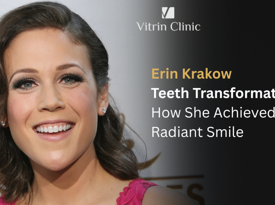 Erin Krakow Teeth: The Actress's Complete Smile Evolution