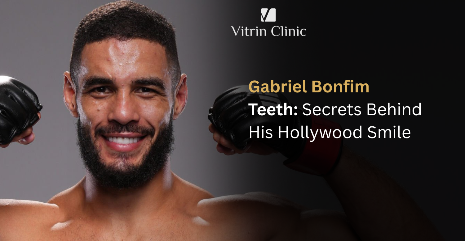Gabriel Bonfim Teeth