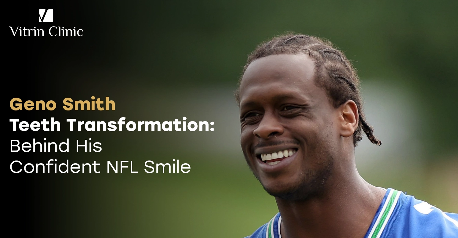 Geno Smith teeth