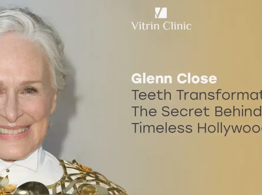 Glenn Close Teeth: The Actress's Timeless Smile Evolution