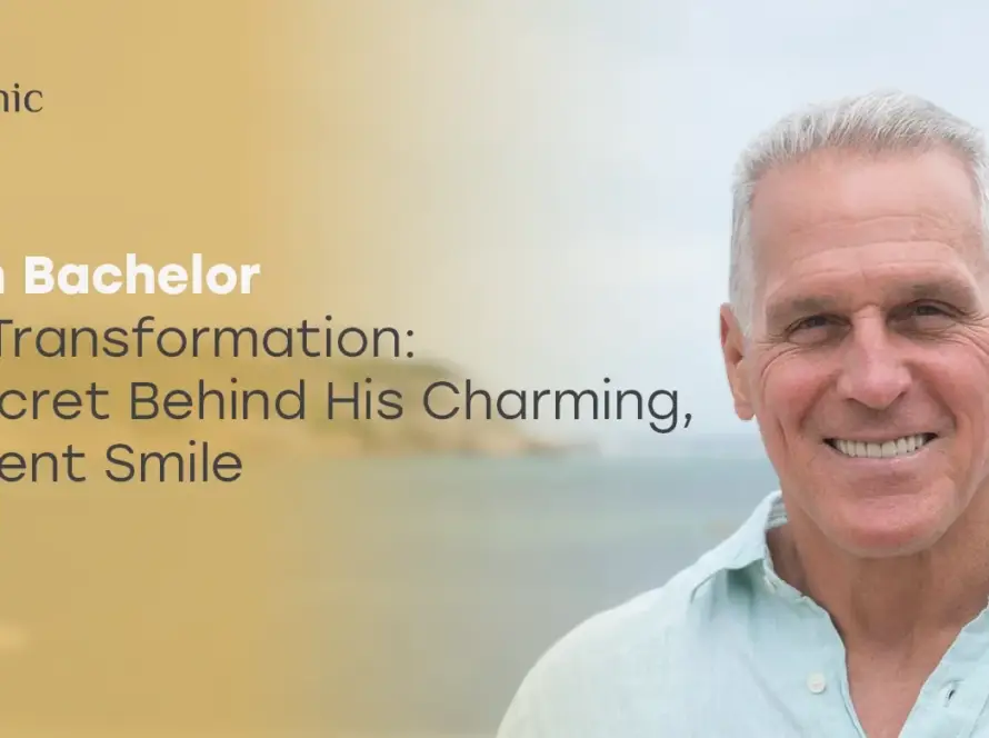 gerry turner teeth