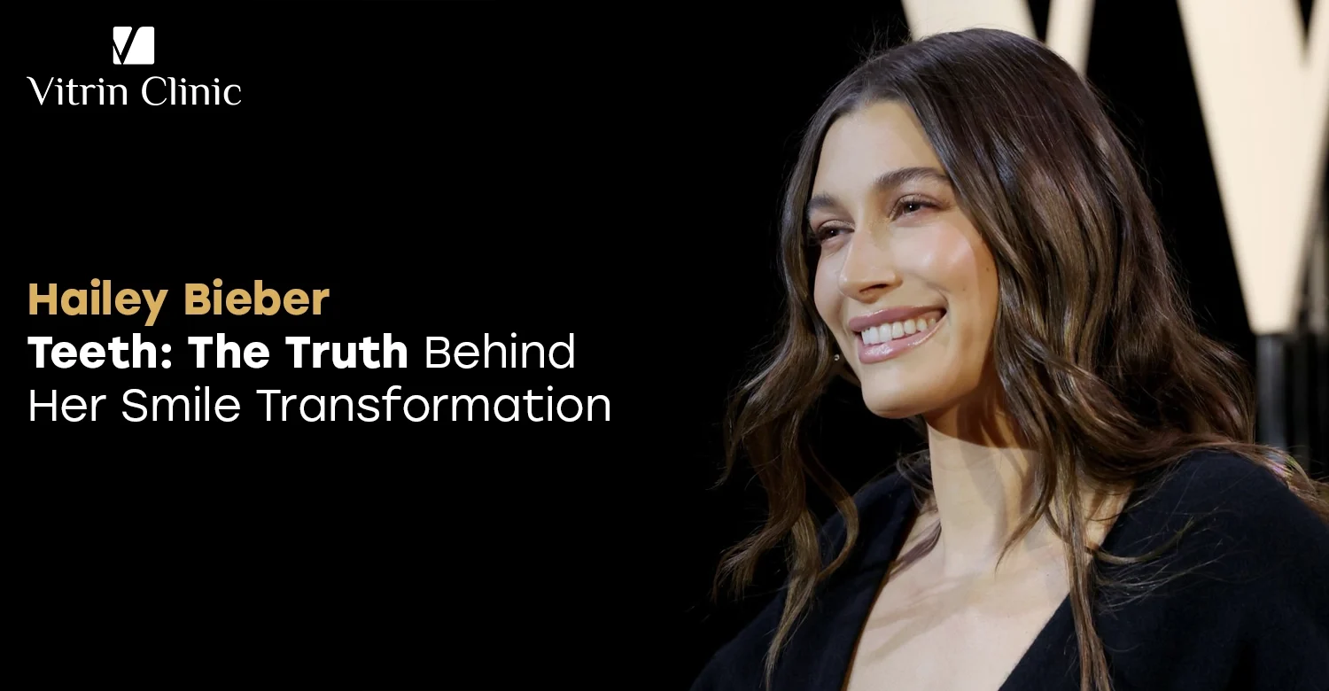 Hailey Bieber Teeth: Her Model-Perfect Smile Aesthetic