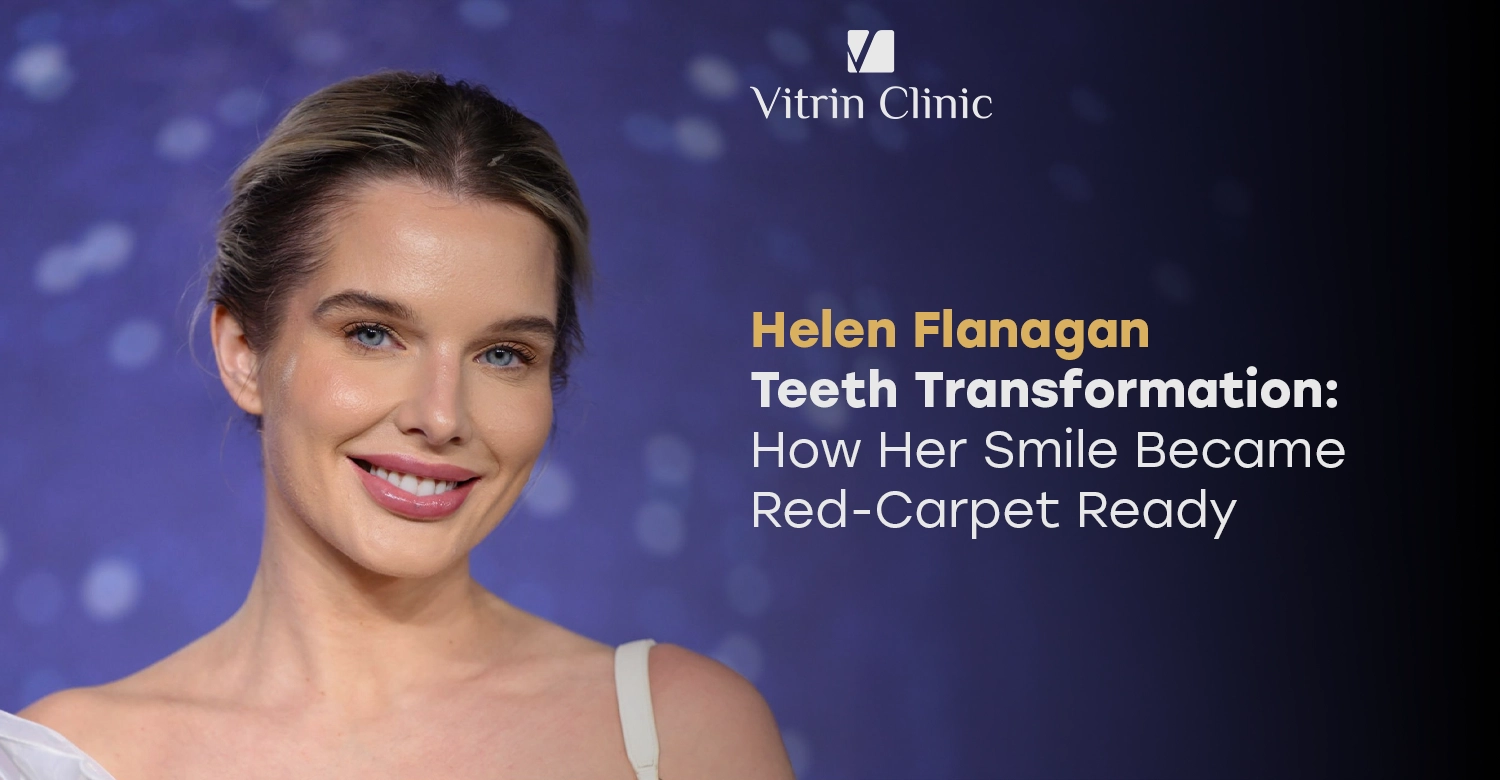 Helen Flanagan Teeth: The Actress's Complete Smile Evolution