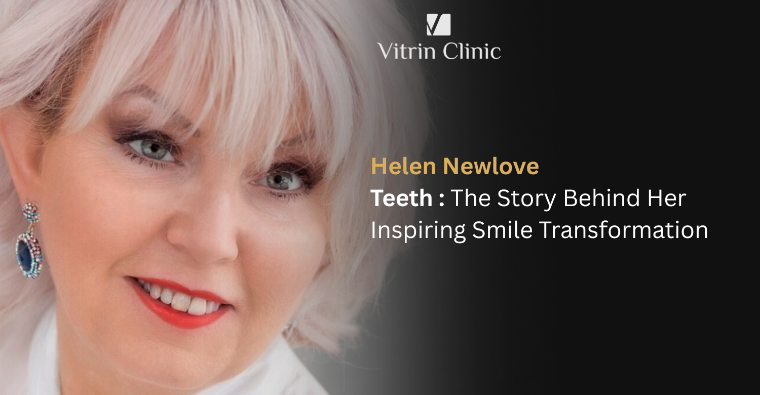 Helen Newlove Teeth