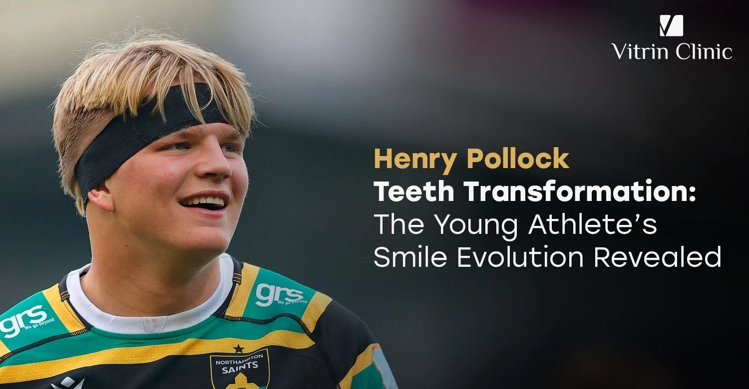 Henry Pollock Teeth Transformation