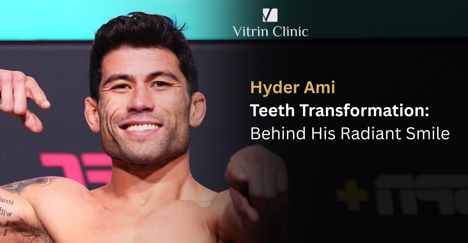 Hyder Amil Teeth Transformation