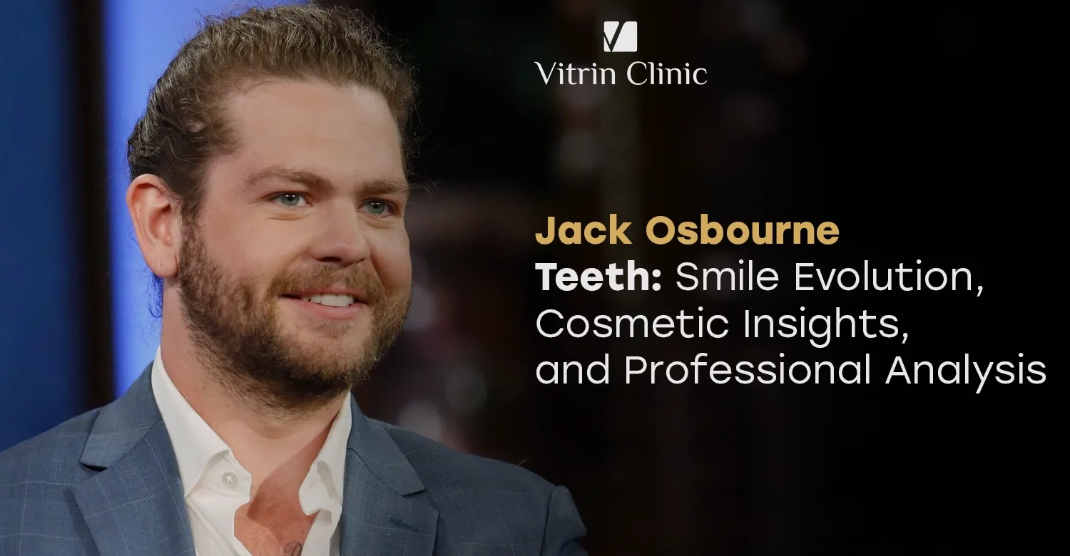 Jack Osbourne Teeth