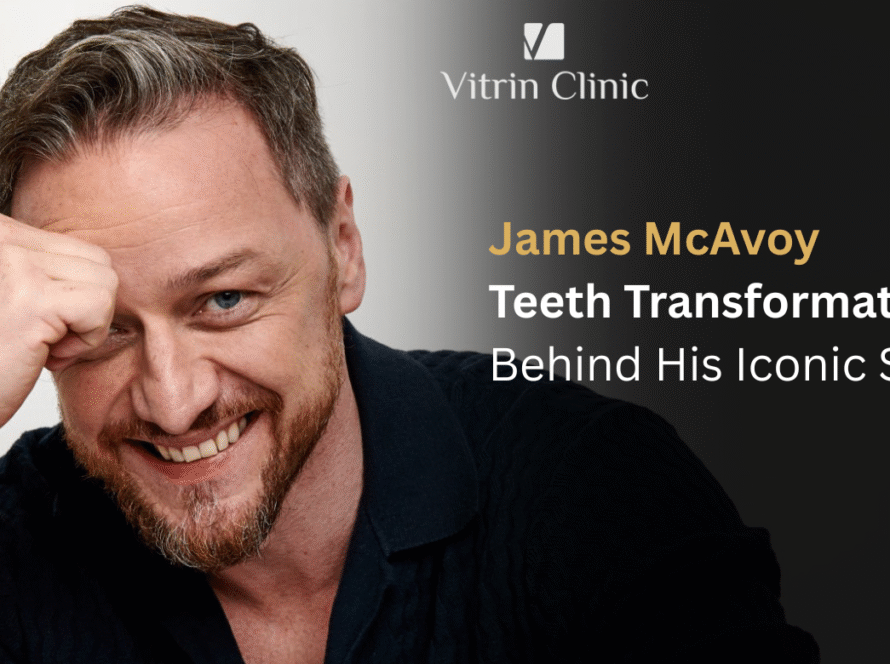 James McAvoy Teeth: The Actor's Complete Smile Evolution