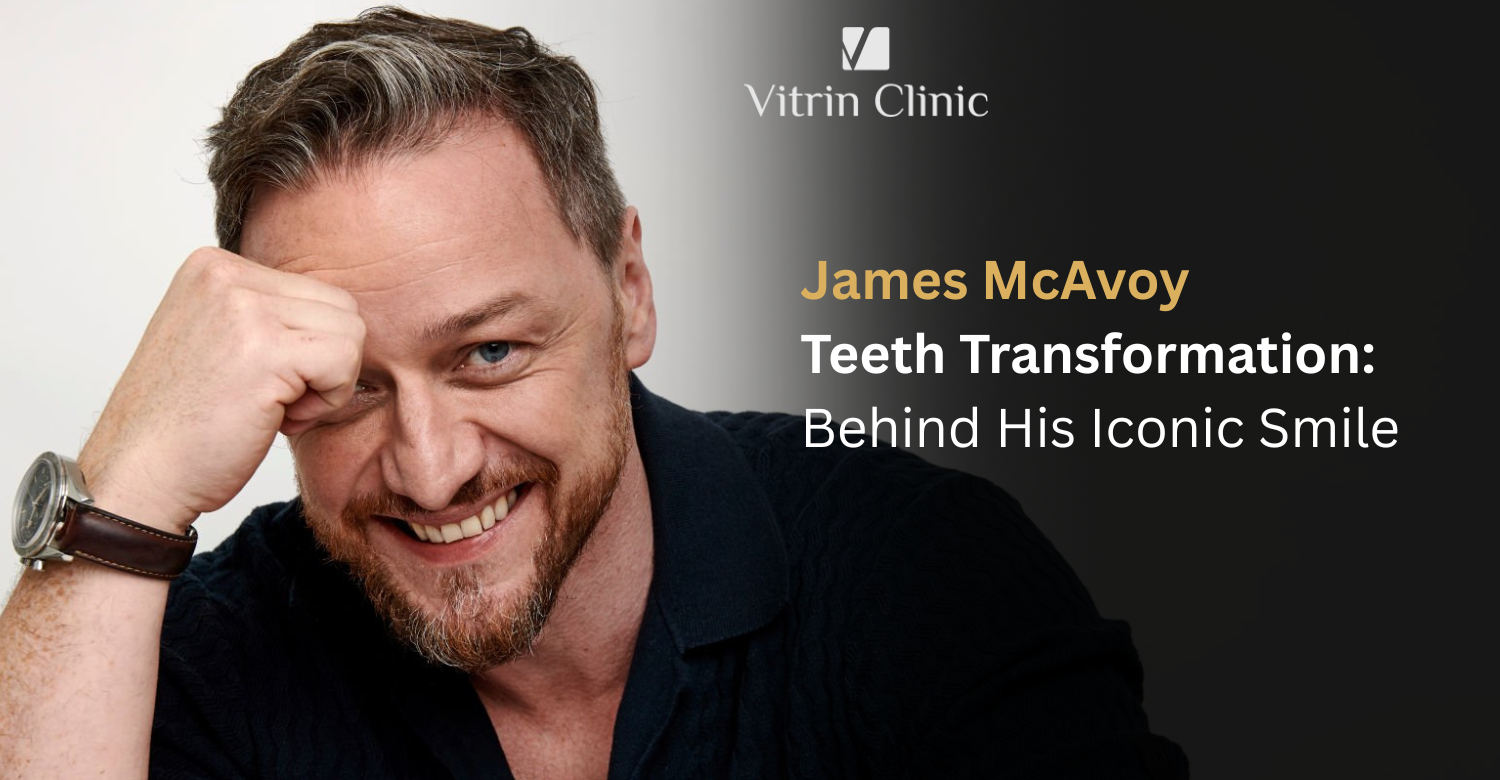 James McAvoy Teeth: The Actor's Complete Smile Evolution