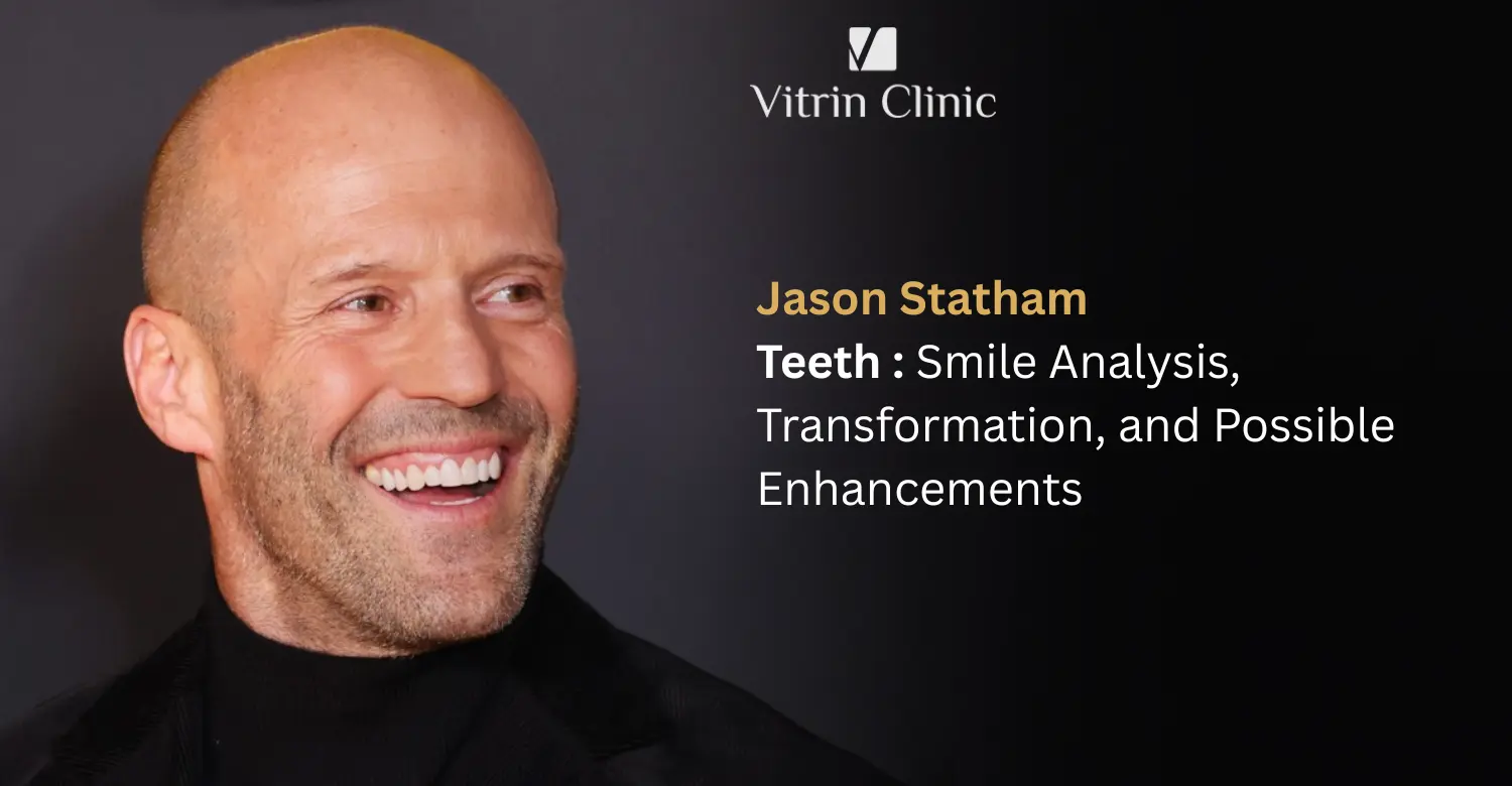Jason Statham Teeth: The Action Star's Complete Smile Evolution