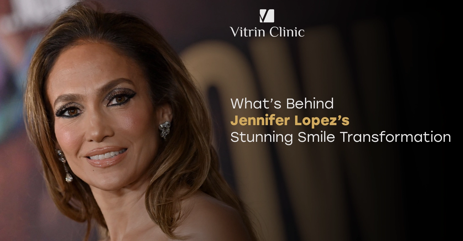 Jennifer Lopez teeth