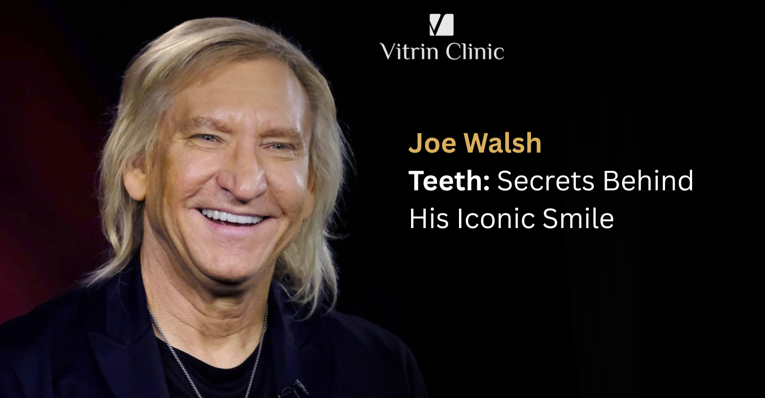 Joe Walsh Teeth: The Rock Legend's Complete Smile Evolution