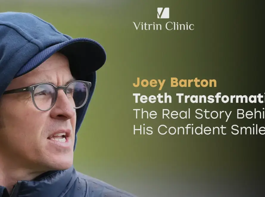 Joey Barton Teeth Transformation: The Real Story Behind His Confident Smile