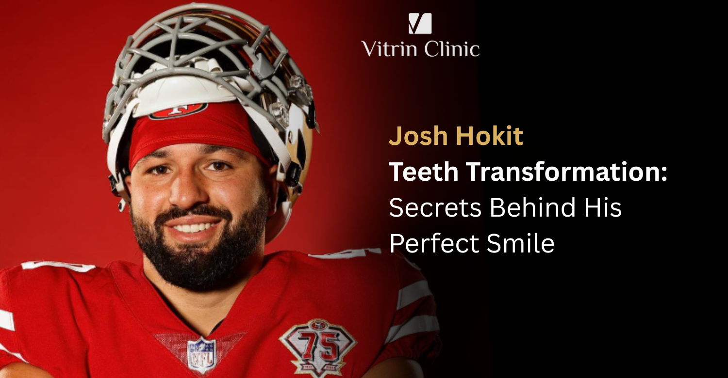 josh hokit teeth