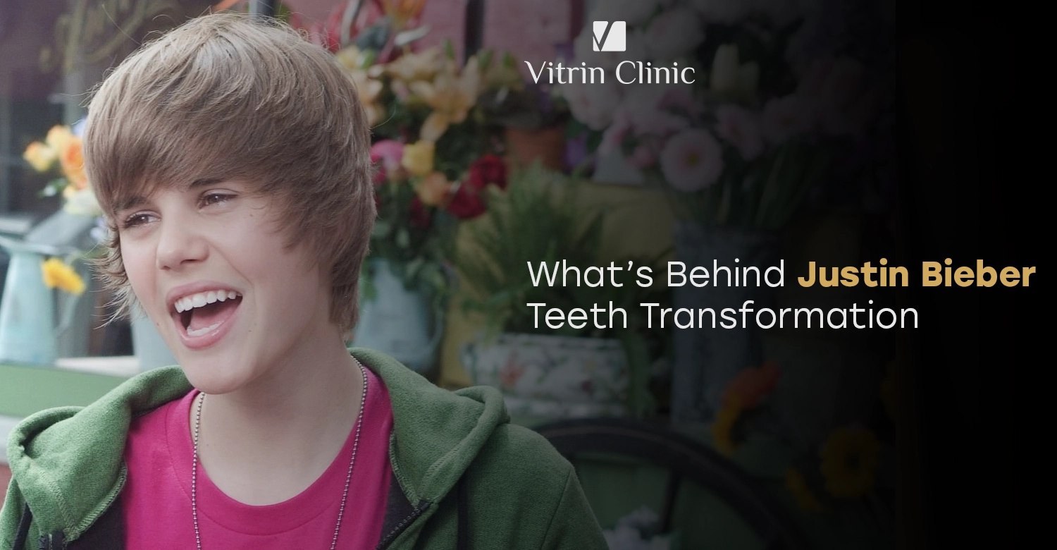 Justin Bieber Teeth: The Complete Smile Evolution in 2025–2026