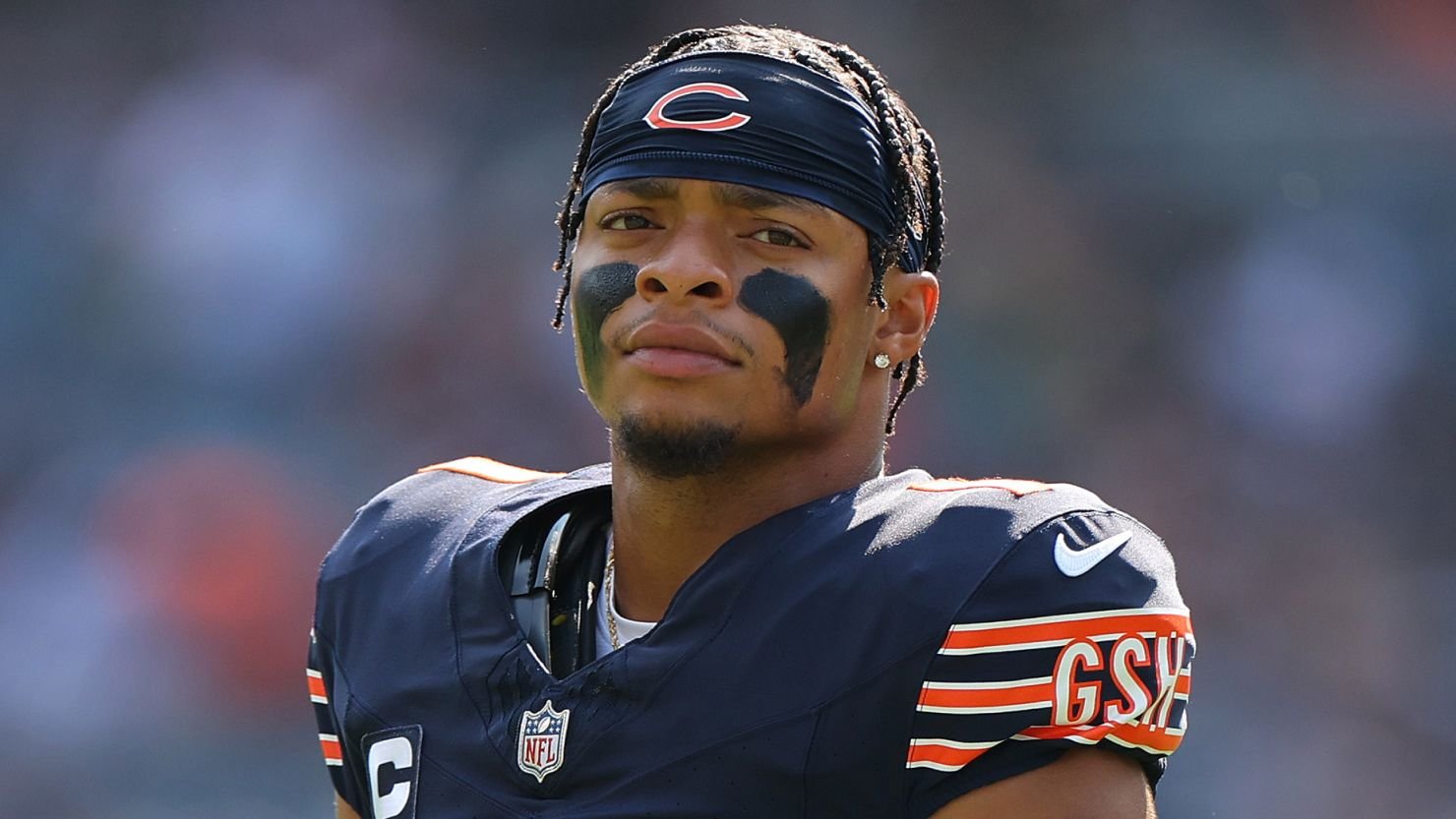 Did Justin Fields Get Veneers or Other Cosmetic Dental Work?