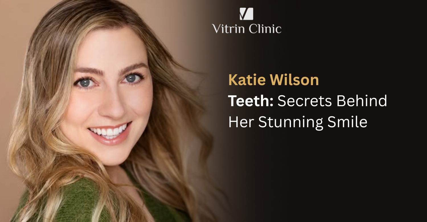 Katie Wilson Teeth