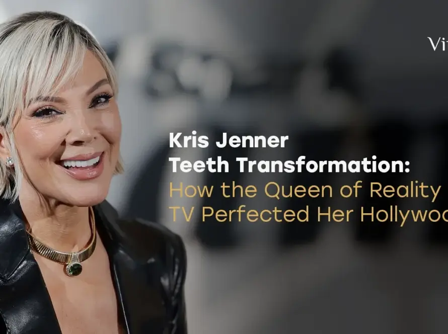 Kris Jenner Teeth Transformation