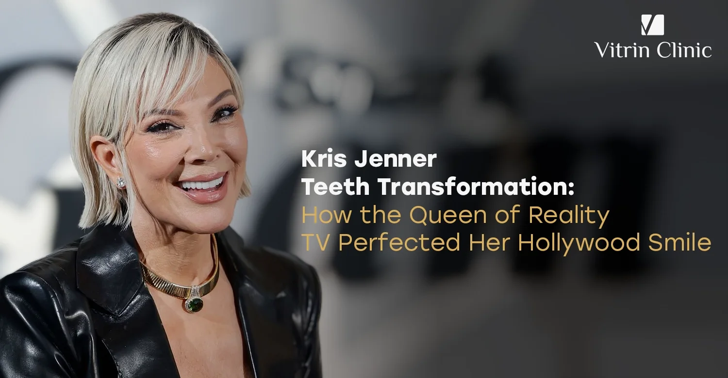 Kris Jenner Teeth Transformation