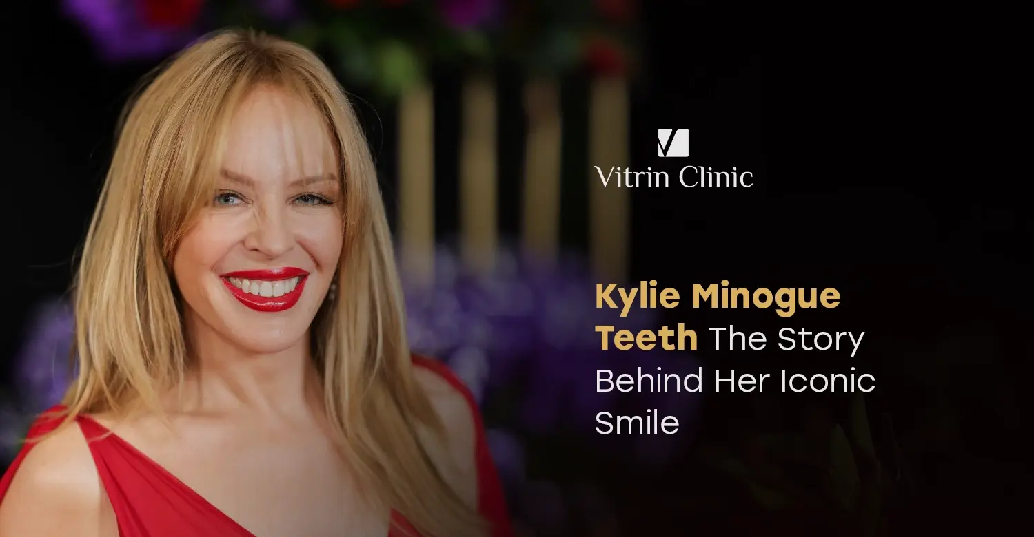 Kylie Minogue Teeth