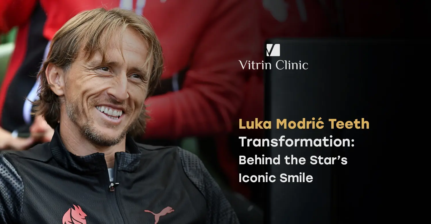 Luka Modrić Teeth Transformation: Before & After, Veneers & Hollywood Smile