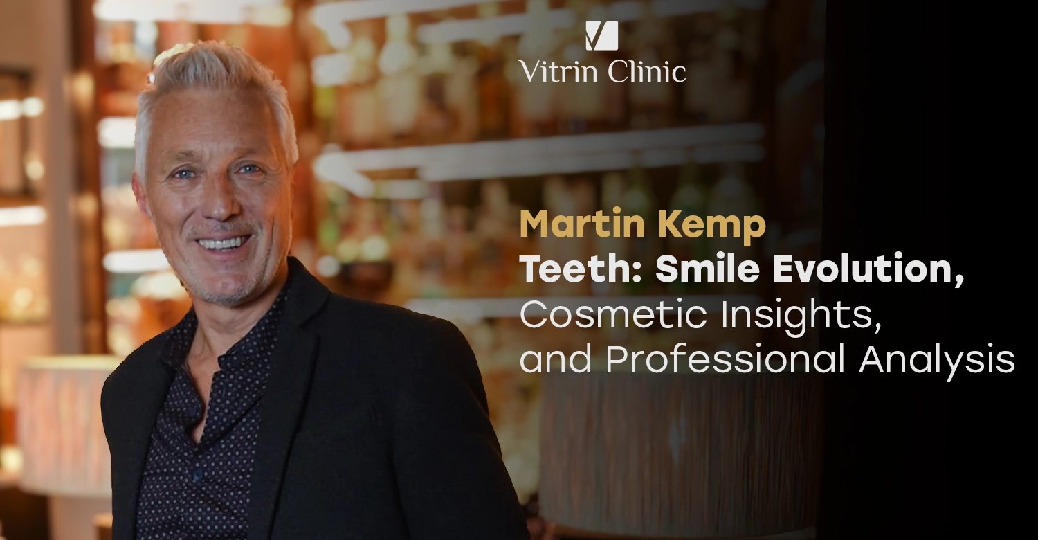 Martin Kemp Teeth