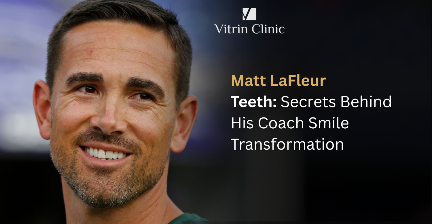 Matt LaFleur Teeth