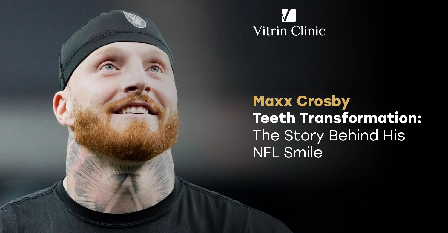 Maxx Crosby Teeth: The DE's Gritty & Fierce Smile