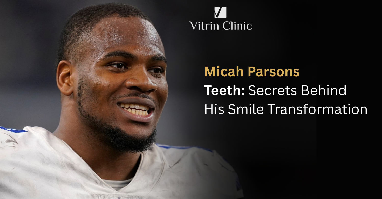 Micah Parsons Teeth