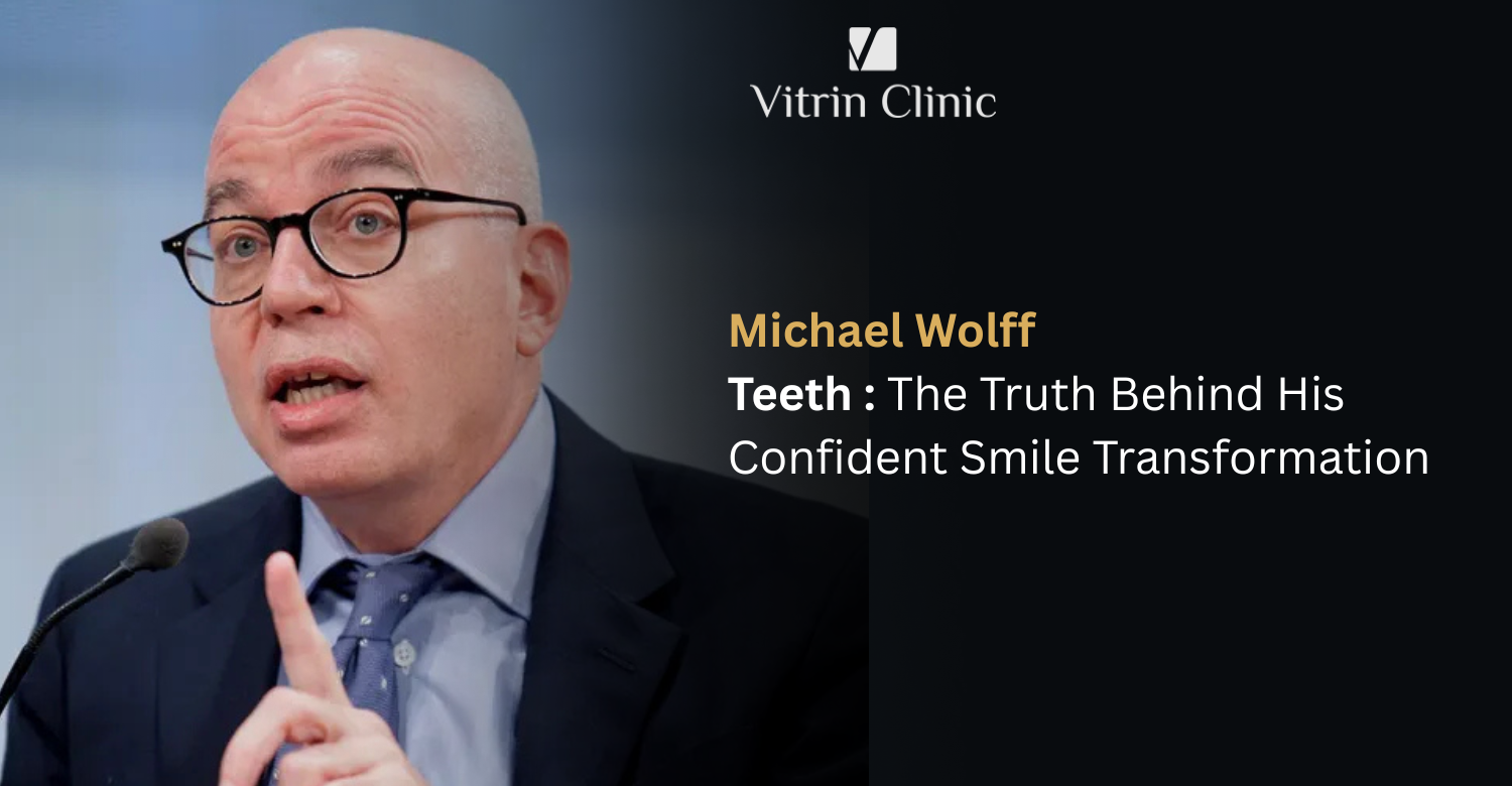 Michael Wolff Teeth