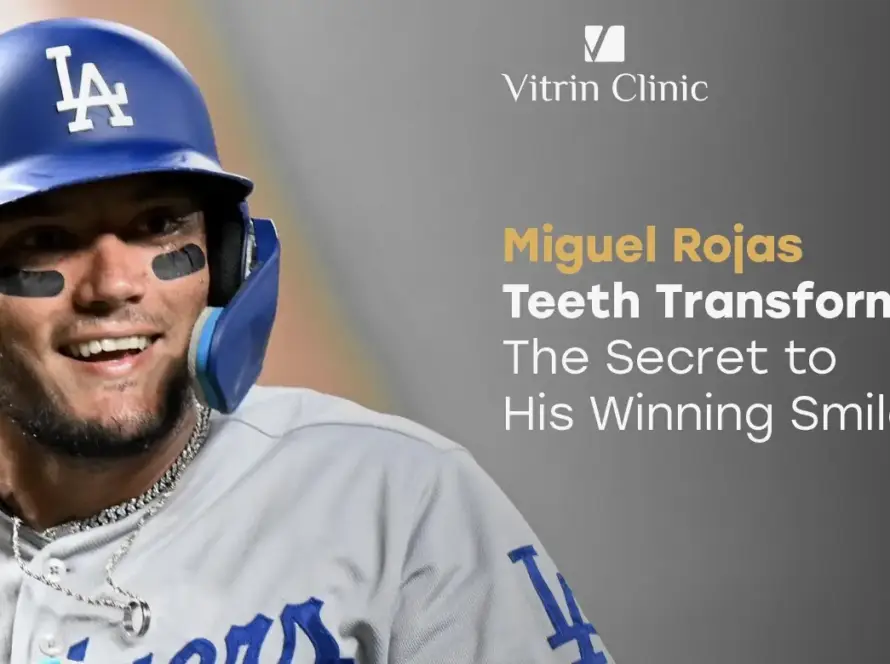 Miguel Rojas Teeth Transformation: The Secret to His...