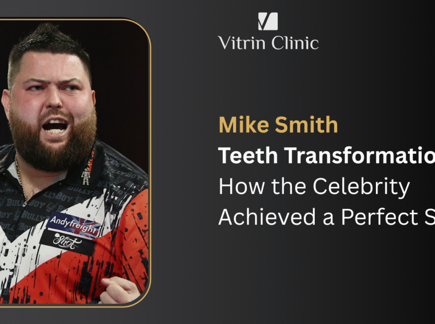 Mike Smith Teeth Transformation: How the Celebrity Achieved a Perfect Smile