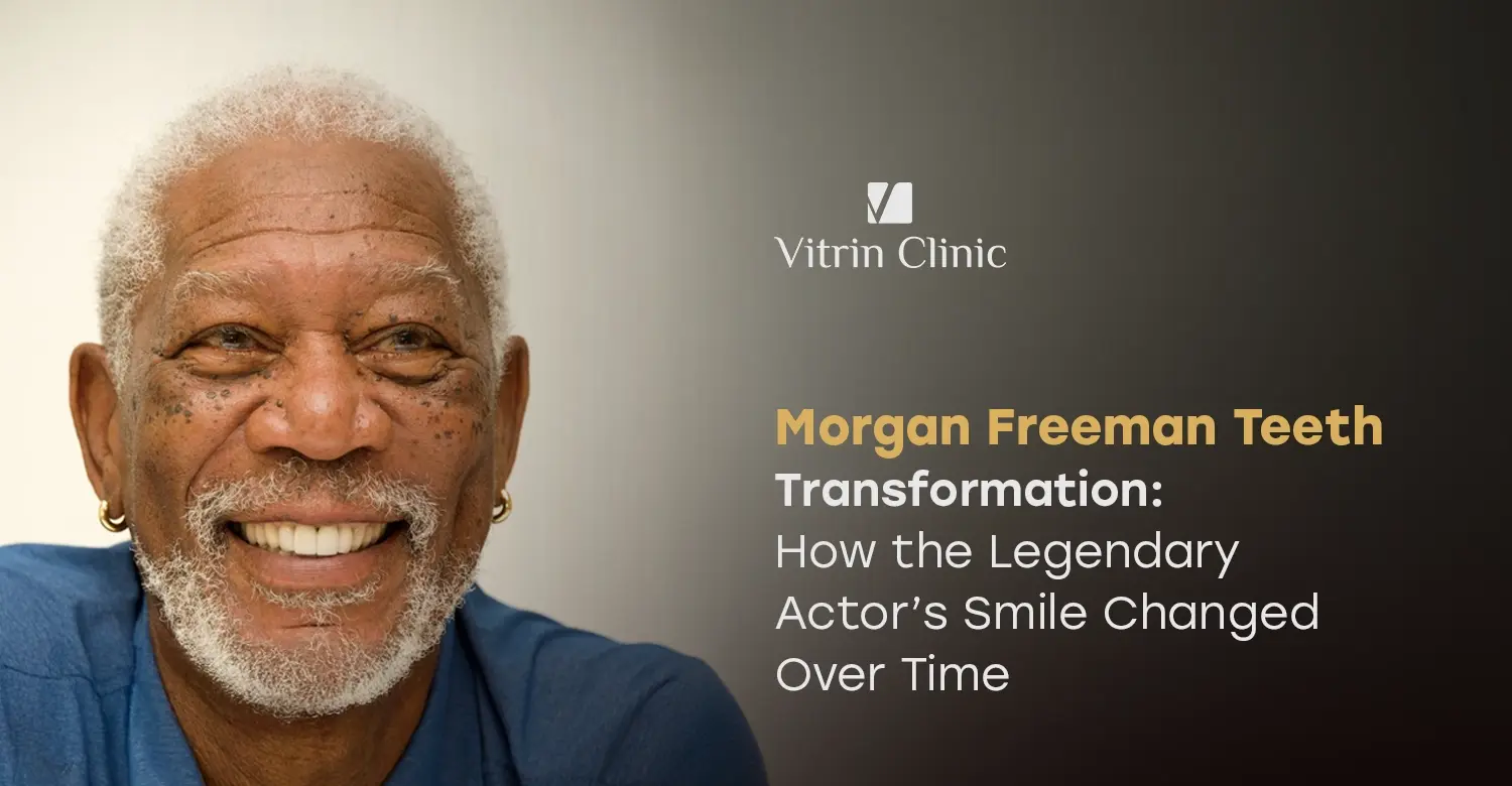 Morgan Freeman Teeth