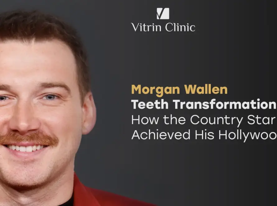 Morgan Wallen teeth