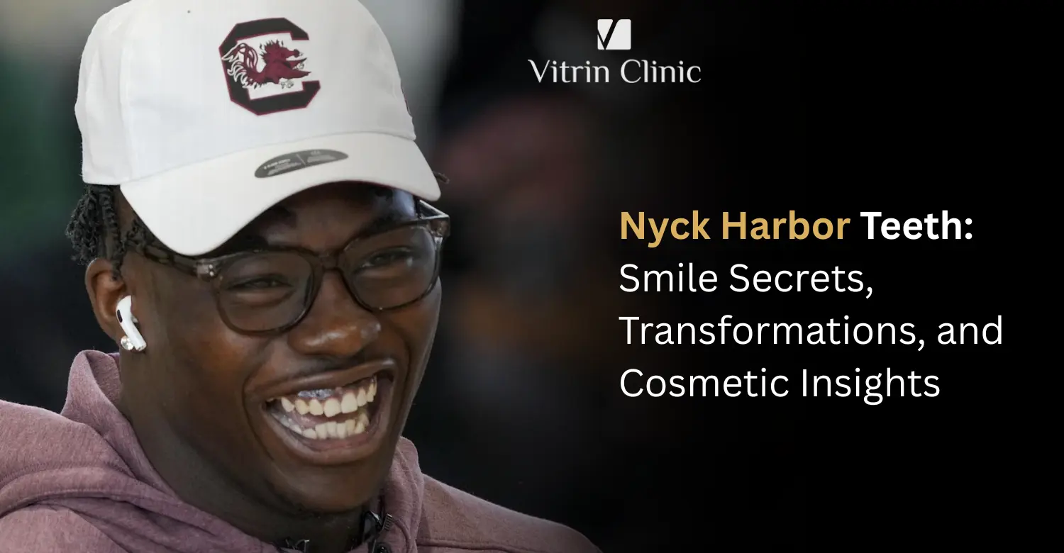 Nyck Harbor Teeth