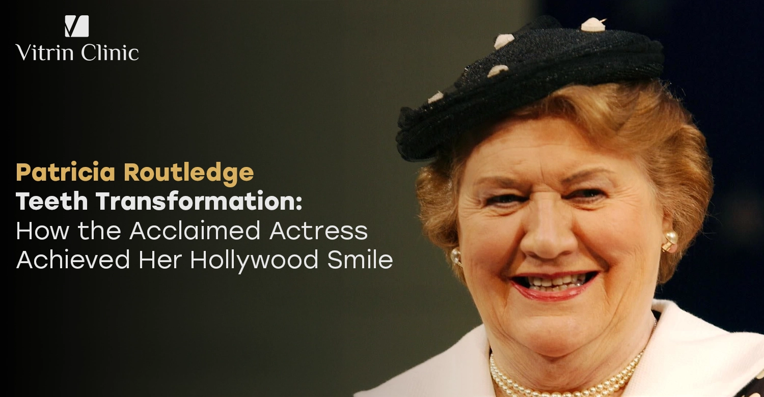 Patricia Routledge teeth